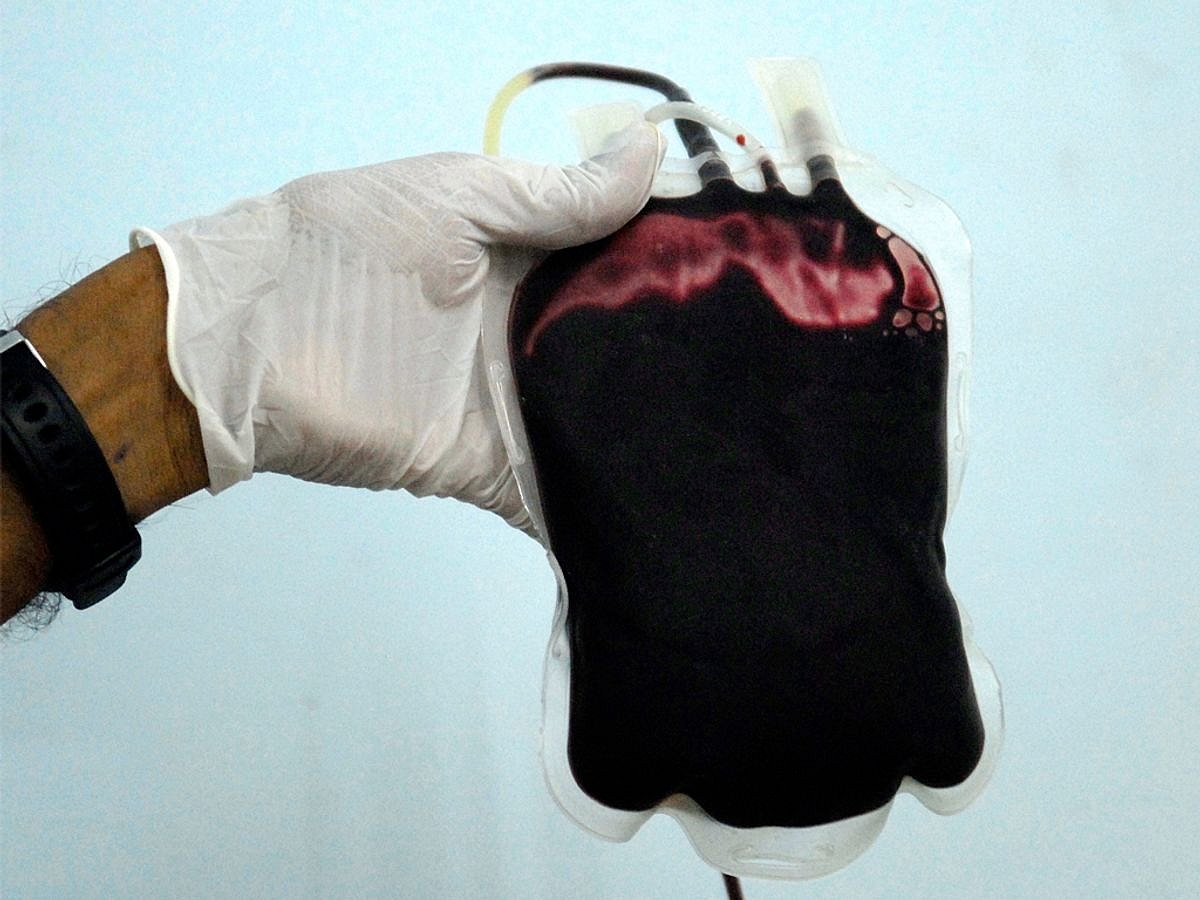 Lockdown woes: Thalassemic kids face shortage of blood