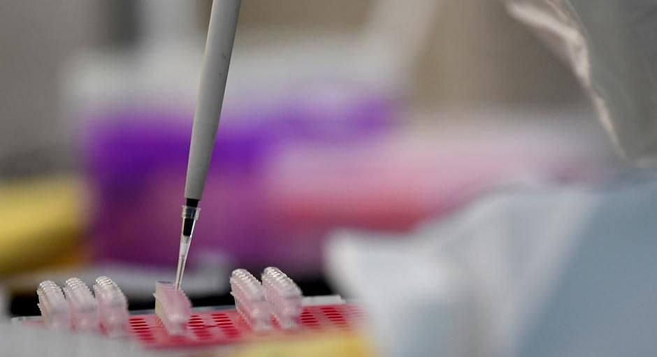 Chinese researchers identify neutralising antibodies against COVID-19 identified  