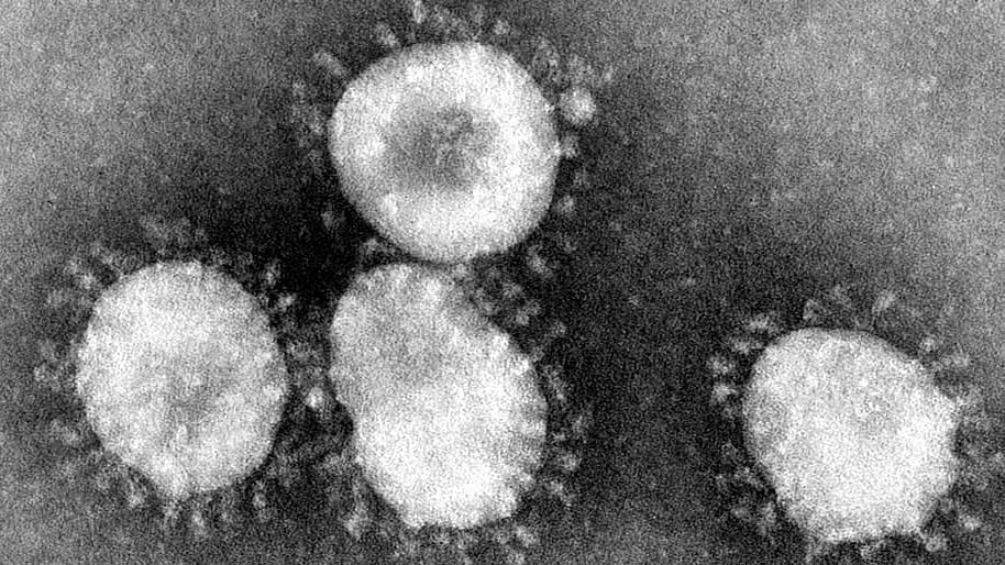 China: One dead from new virus