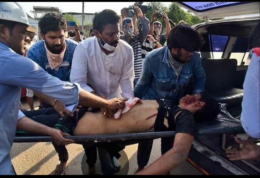 Vizag gas tragedy: 11 dead, 240 under treatment, 20 on ventilators, govt asks people not to panic