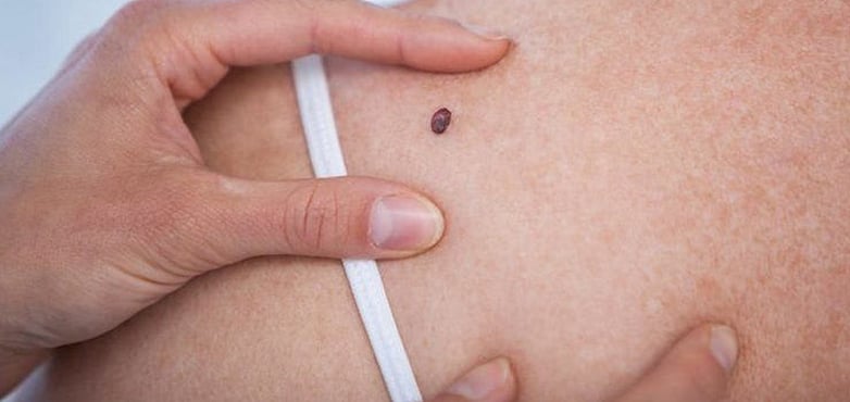 Know, how your psyche affects your skin health  