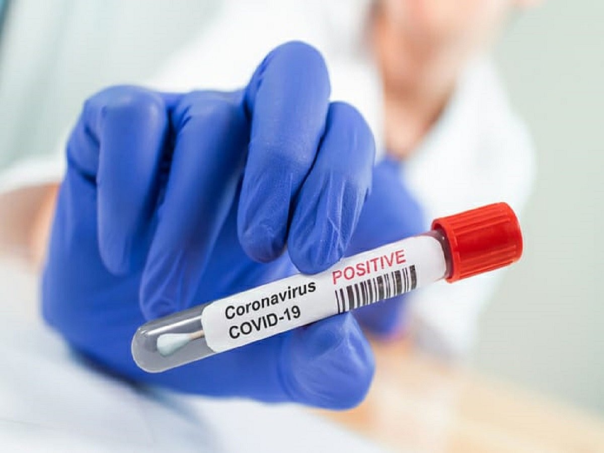 ‘Herd immunity doesn’t seem to work for COVID-19, need to be careful’