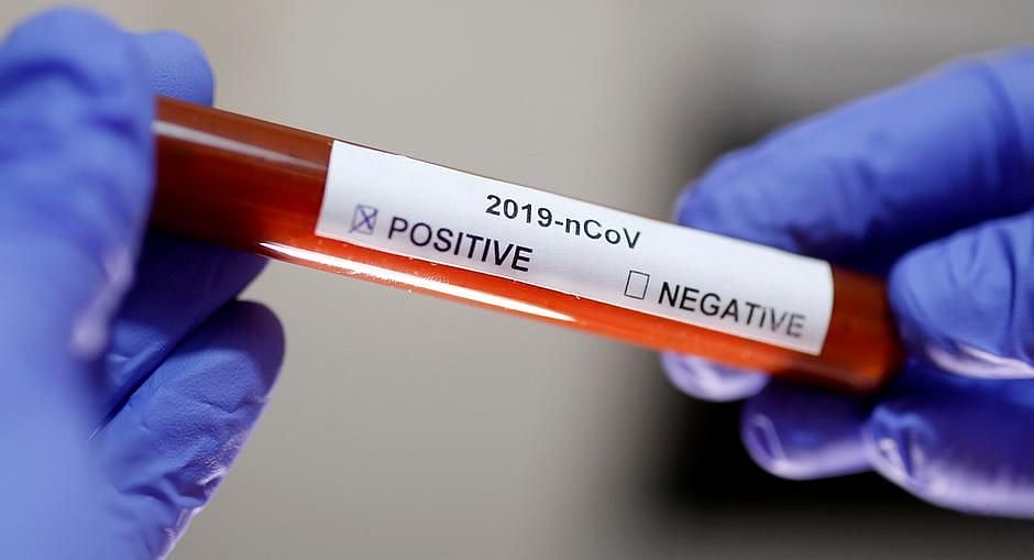 People coming to Delhi from 5 states will need to show negative COVID-19 test result: Officials