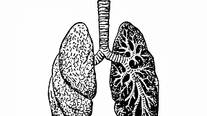 Long Covid: Mild infections can lead to hidden lung damage