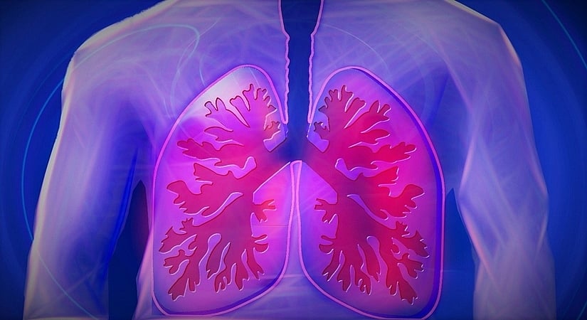 Respiratory failure in COVID-19 not driven by cytokine storm: Study