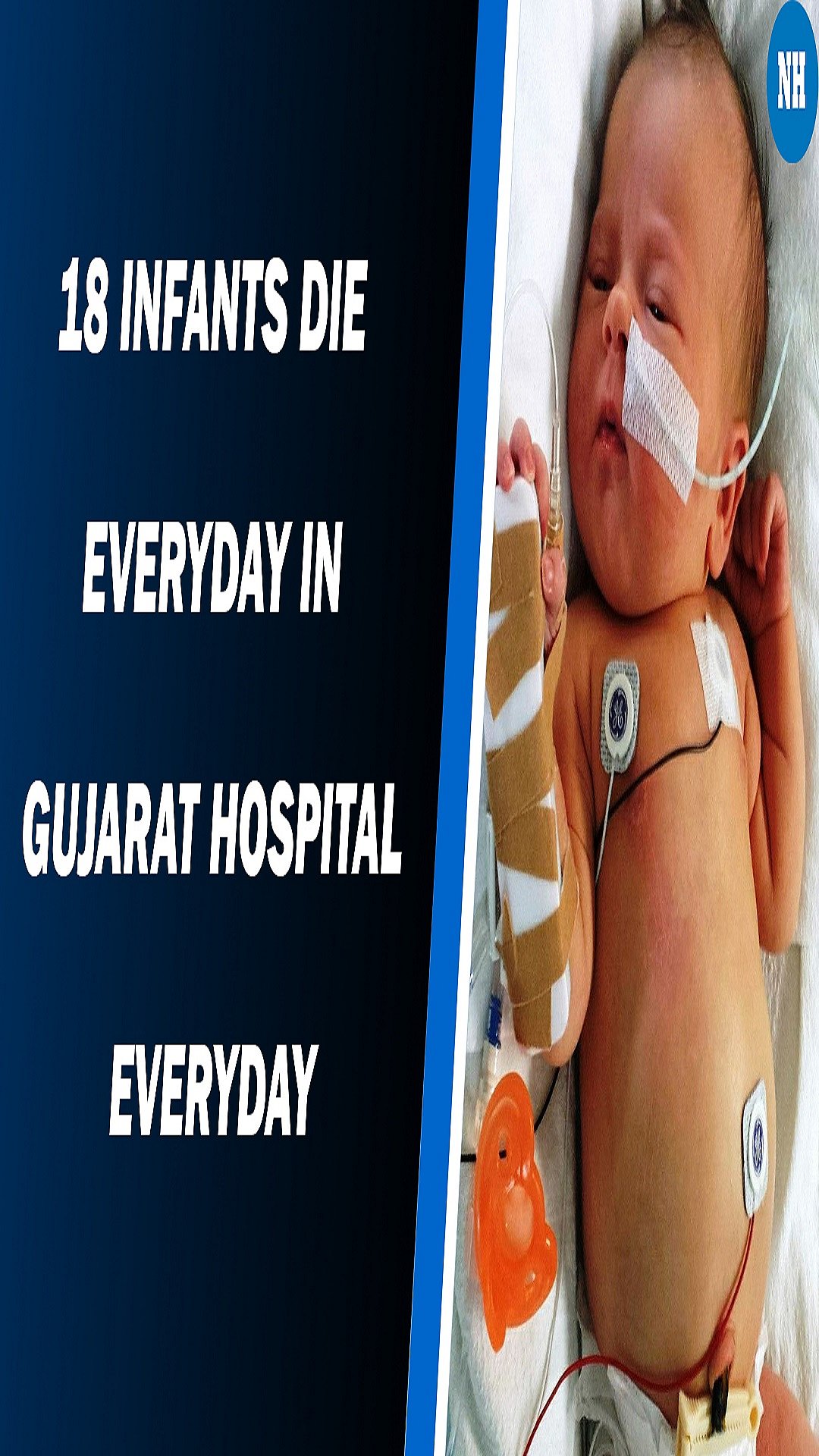 18 newborns died every day within hours of their birth in Gujarat in 2019-20 