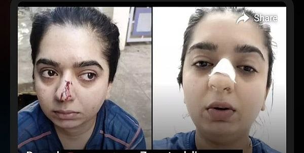 Zomato delivery executive mugged me, says Bengaluru model  