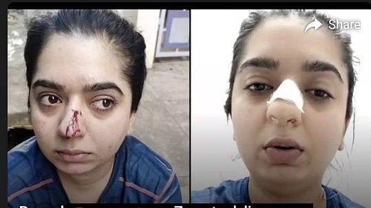 Zomato delivery executive mugged me, says Bengaluru model