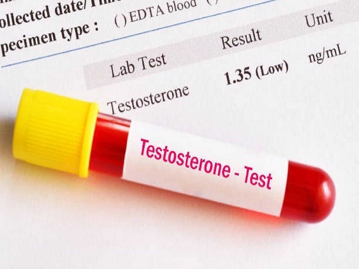Low testosterone in men linked to severe COVID risk