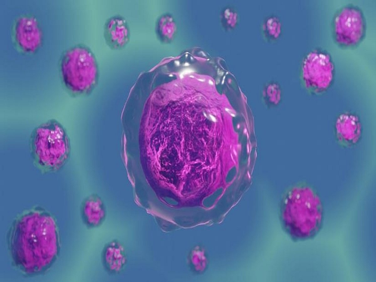 New drug combo found effective against high-risk leukaemia