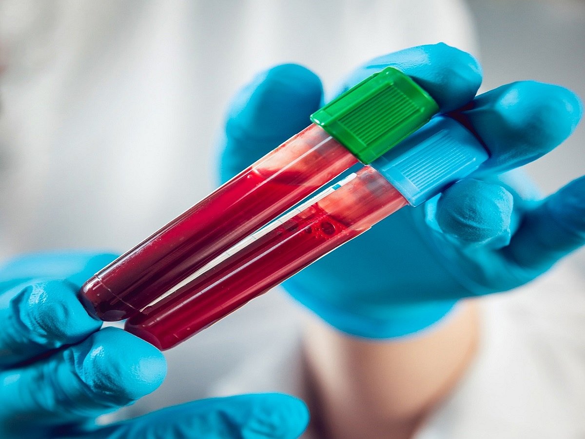 CAR T-cell therapy effective in treatment of rare cancer in children