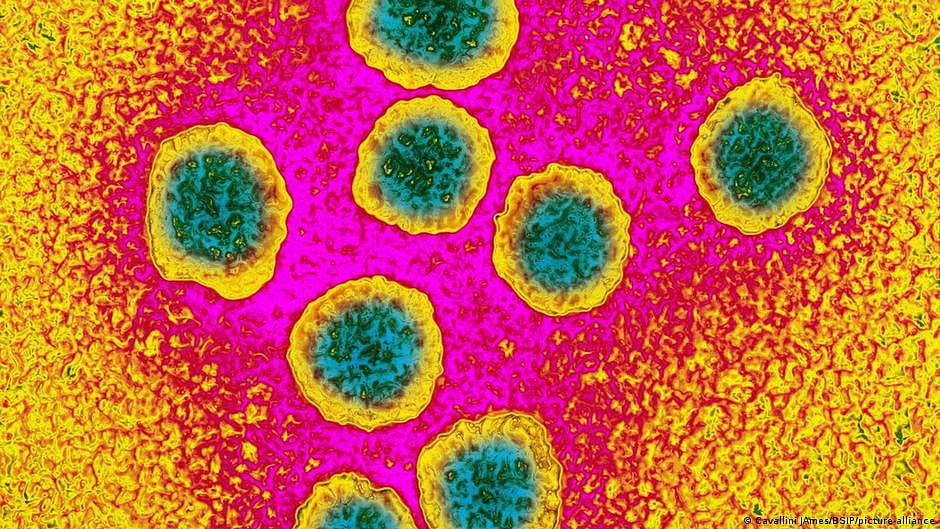 The AI model can identify both common cancers and rare cancers that are notoriously difficult to diagnose. Representative image