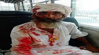 A farmer injured in the police lathicharge
