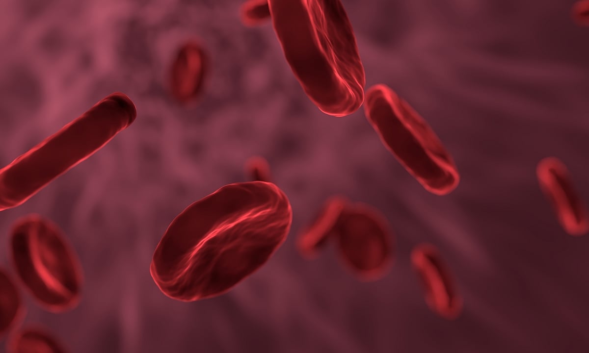 Covid-19 linked to high risk of blood clots during surgery