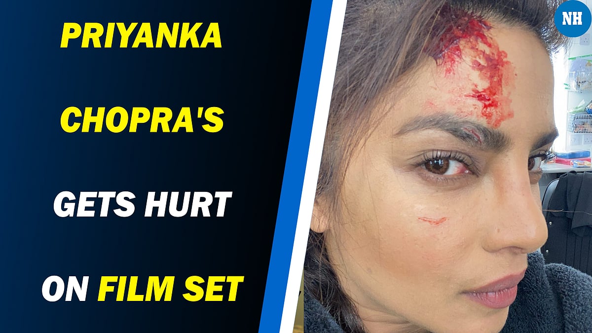 PC posted a selfie of her wound