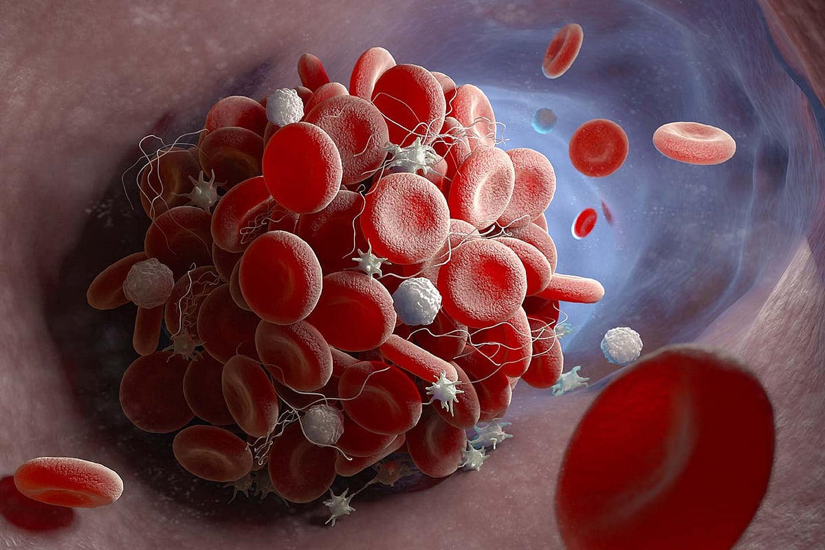 Blood clot risk much higher from COVID-19 than after vaccination: Oxford-led study 