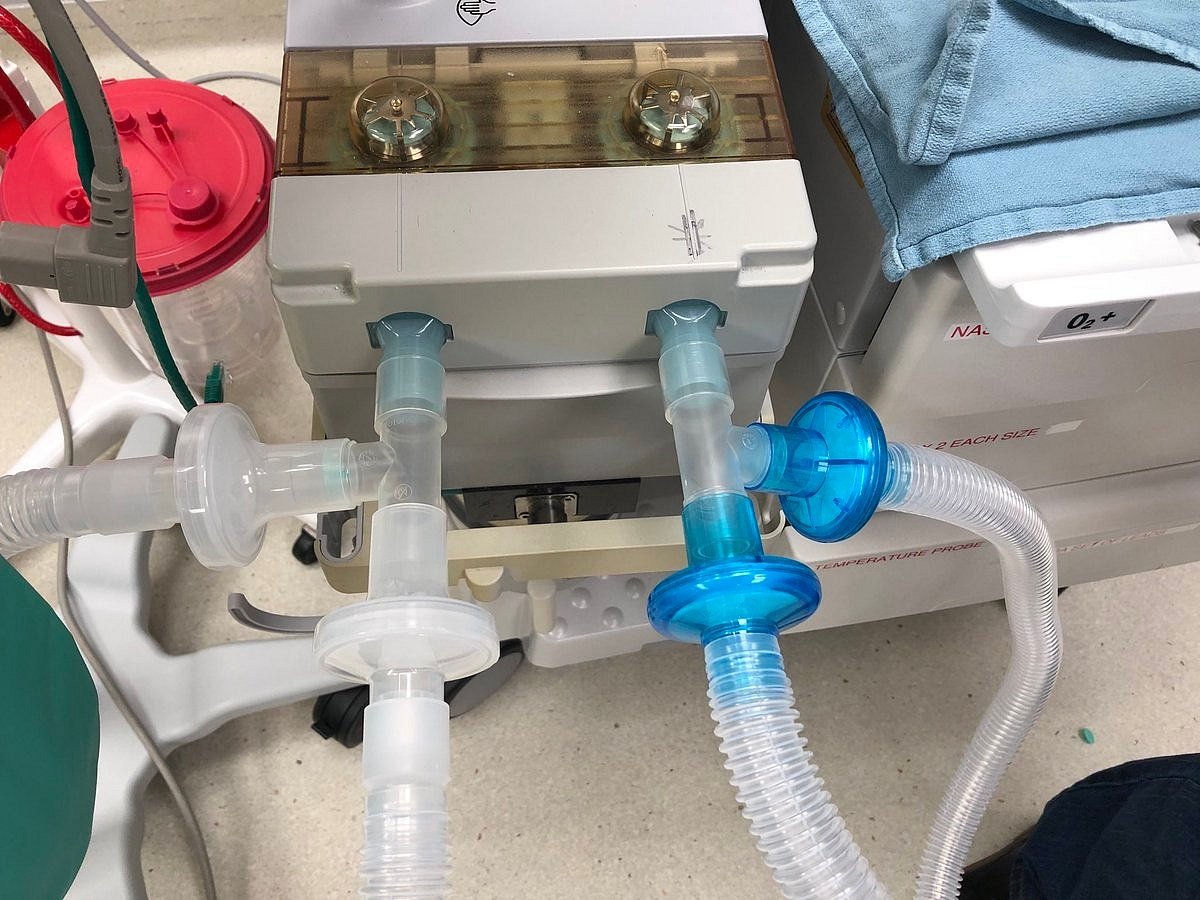 AI to predict Covid patients in dire need for ventilators