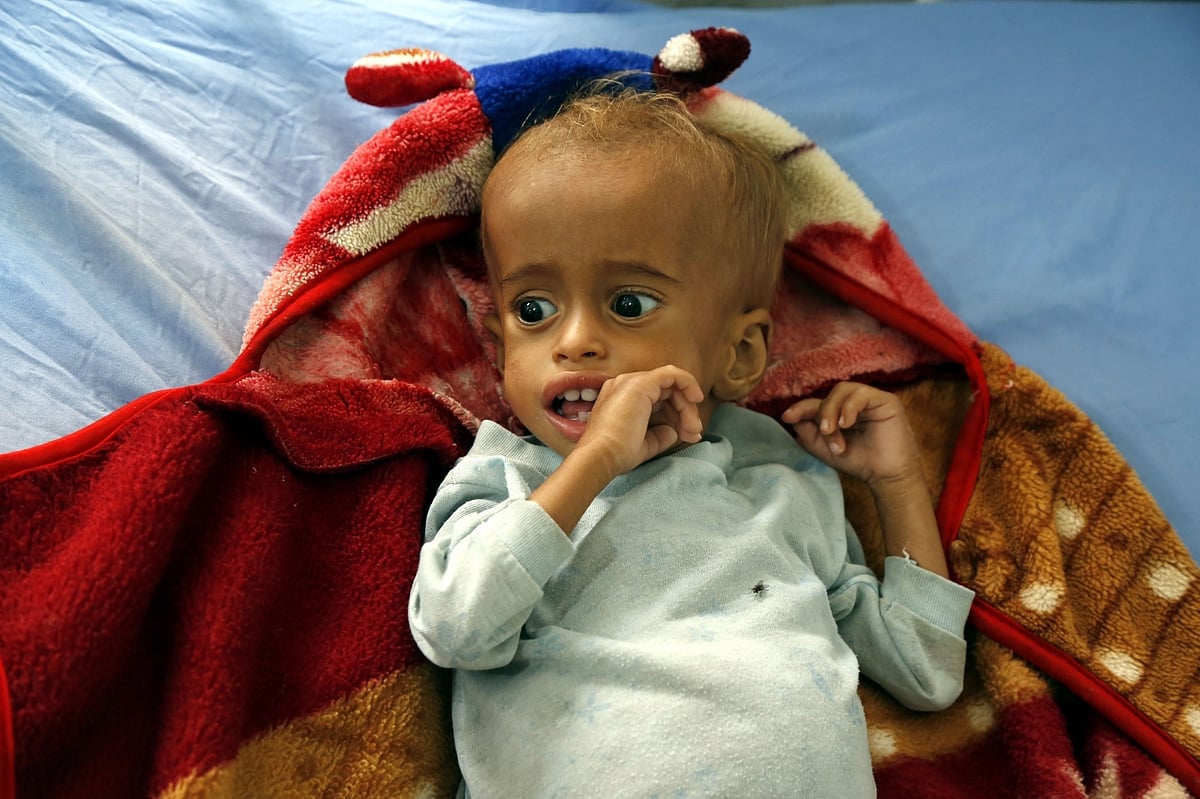 'Identifying, treating malnourished children crucial for healthy India'