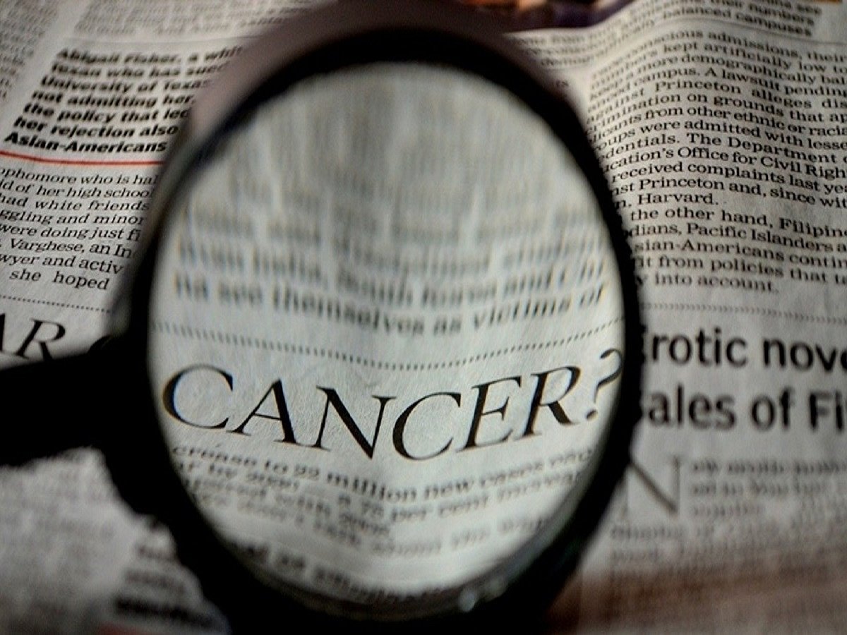 70% patients missed cancer surgery globally during COVID lockdowns