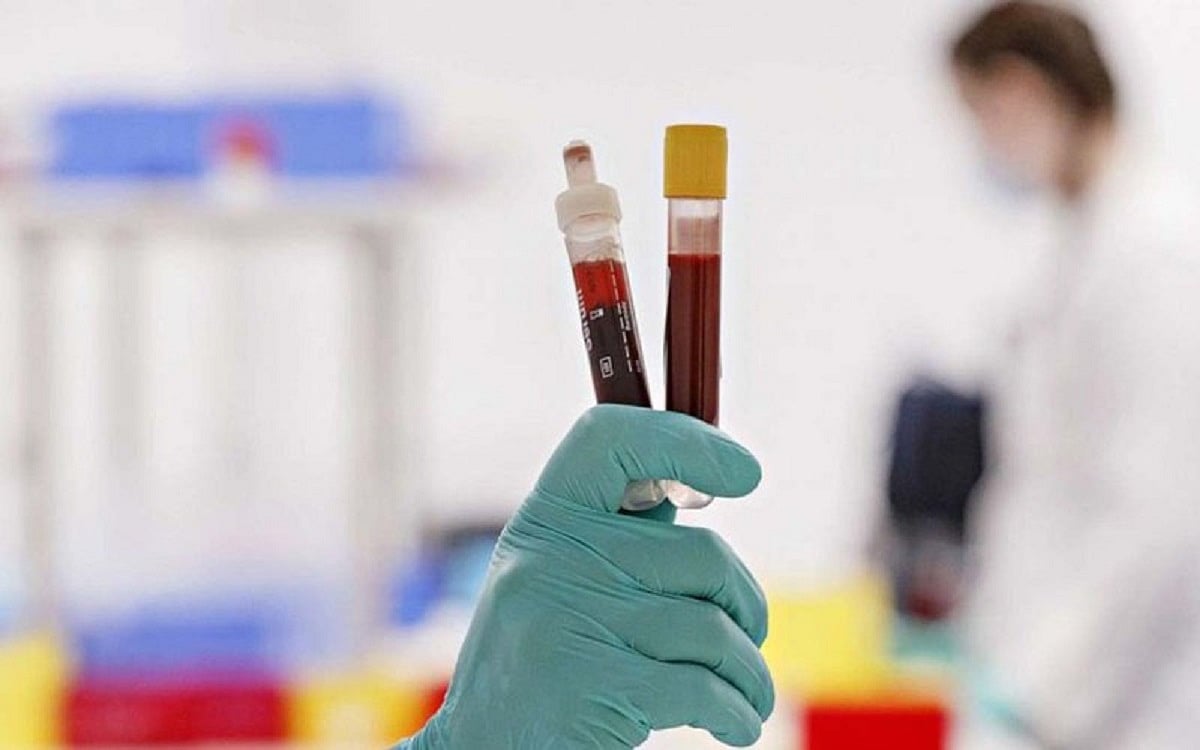 Curing with blood: the rise and fall of COVID convalescent plasma therapy