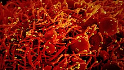  World races to contain new Covid threat, called the Omicron variant; EU countries tighten travel rules