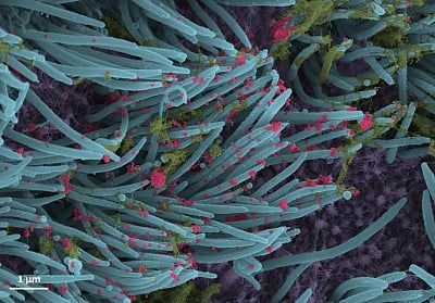 Lethal 'NeoCov' only 1 mutation away from infecting humans: Wuhan scientists