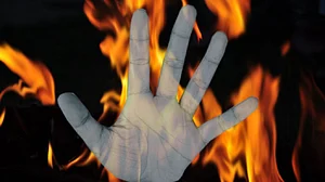 Woman who set herself on fire, dies during treatment