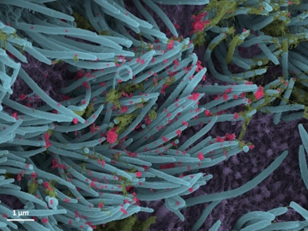 Previous Covid infection may improve performance of antibodies