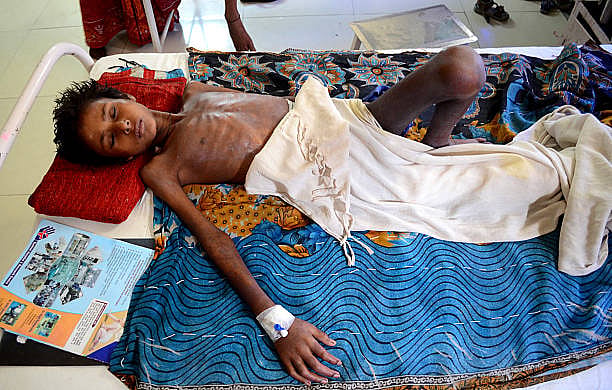 Is it too much to expect Modi govt to take note of report that every third child in India is undernourished?