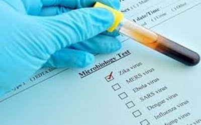 Zika may be a step away from dangerous outbreak