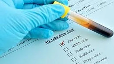 Zika may be a step away from dangerous outbreak