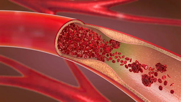 The blood vessel (photo: Getty Images) 