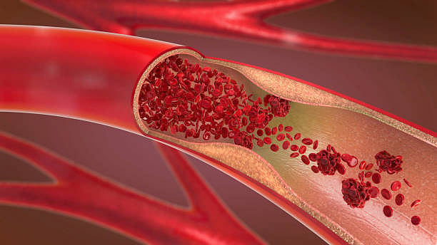The blood vessel (photo: Getty Images) 