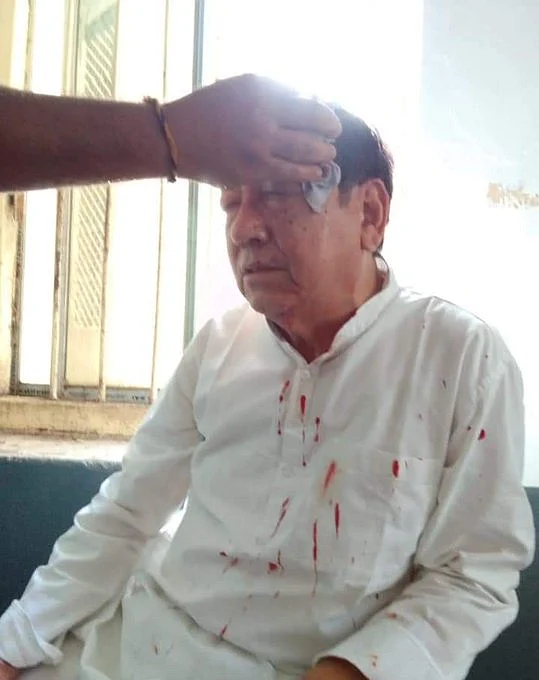 Tripura Congress president Birjit Sinha attacked inside Congress Bhavan in Agartala. A bleeding Sinha has been admitted to a pvt hospital