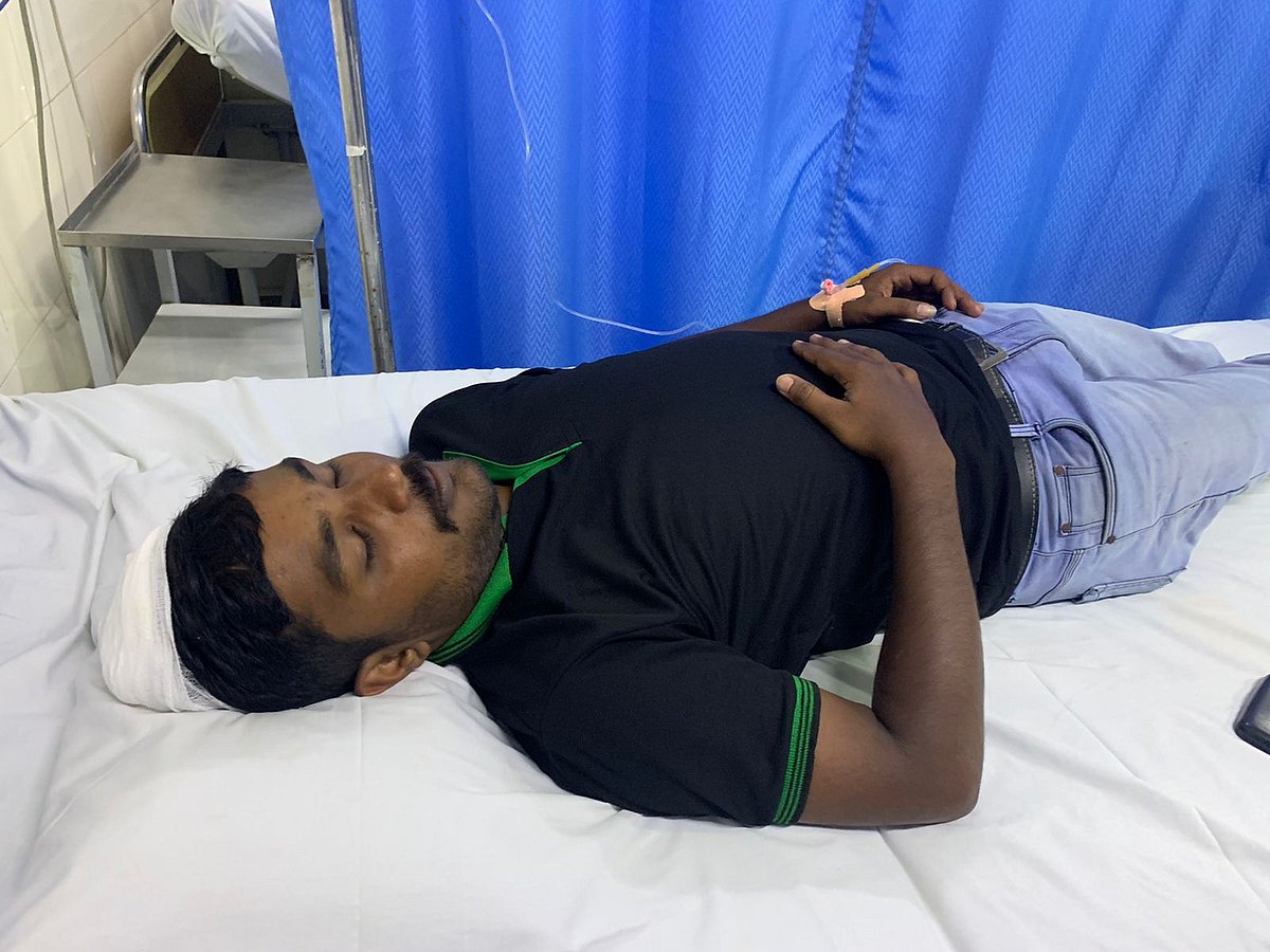 Dinto Jose suffered a skull fracture