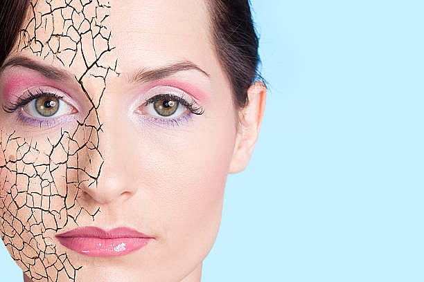 What causes flaky skin?