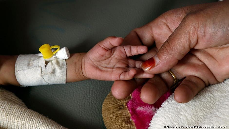 “One third of children aged 12-59 months had anaemia with micronutrient deficiency (iron/ folic acid/ vitamin B12). More than half of children had micronutrient deficiencies irrespective of anaemia,” said a researcher from AIIMS (photo: DW)