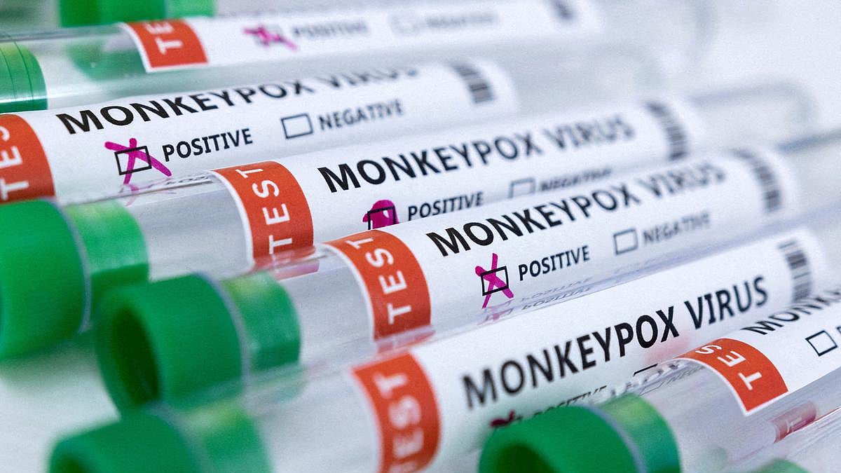 Monkeypox: 4th case detected in India; know all about its causes, symptoms and treatment