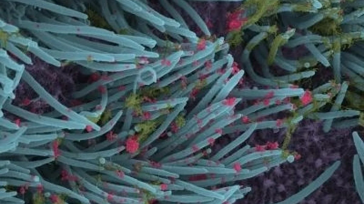 1 in 8 SARS-CoV-2 patients develop long COVID symptoms: Lancet study
