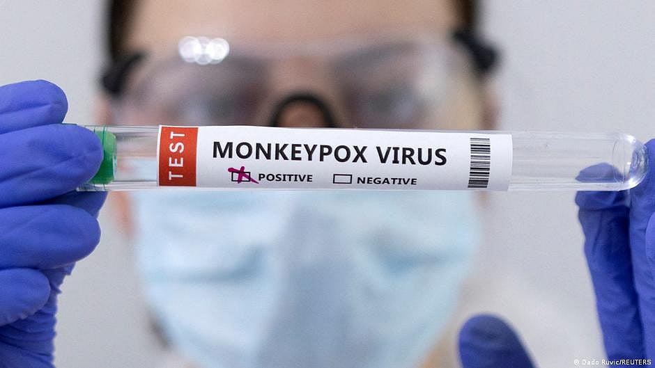 Israel reports new cases of monkeypox, measles