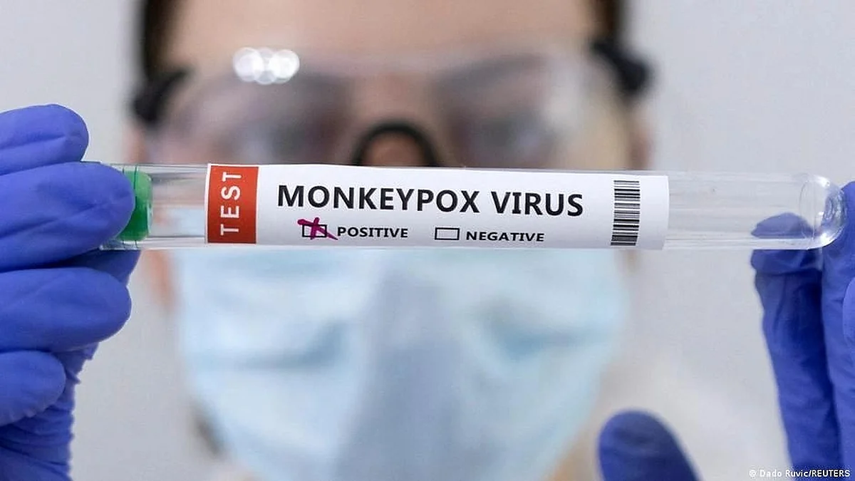Newly reported monkeypox cases dip worldwide: WHO