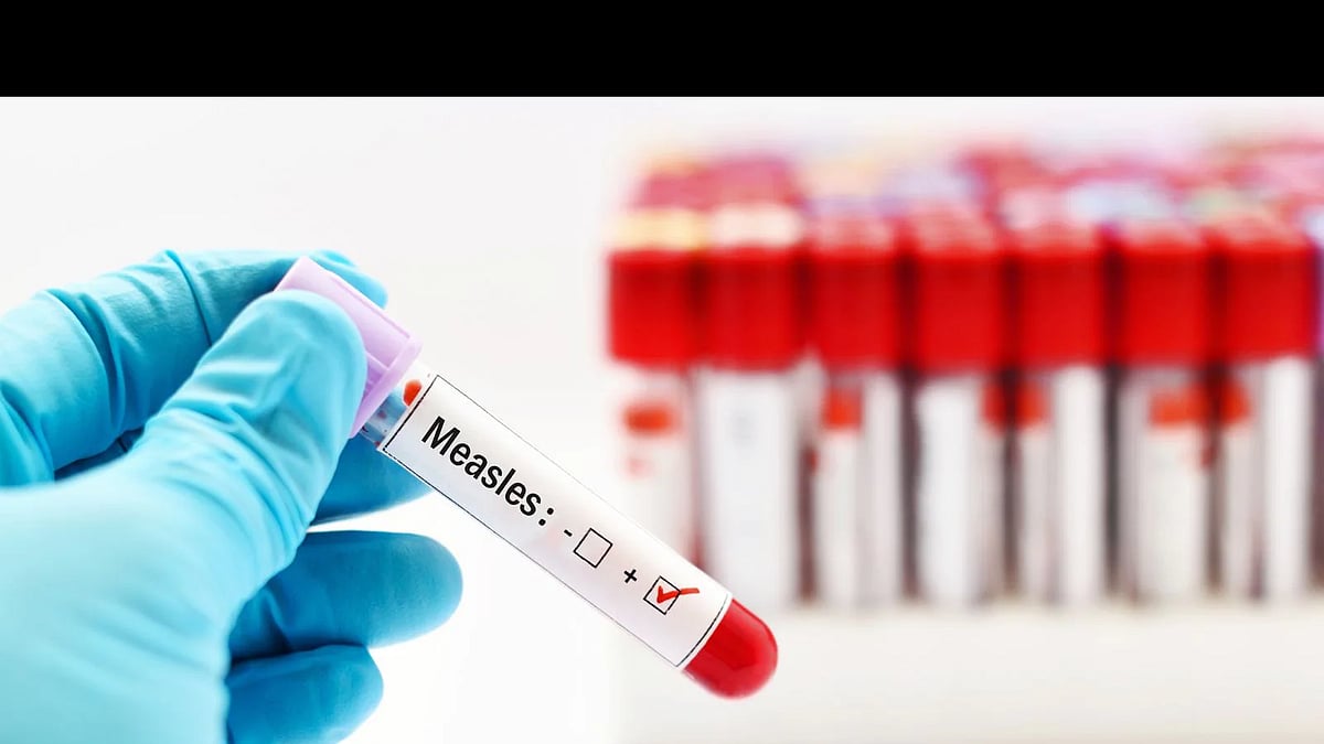Administer one additional dose of measles, rubella vaccines to children in vulnerable areas: Centre to states