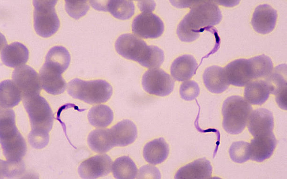 New single-dose drug 95 per cent effective against sleeping sickness in adults: Lancet study