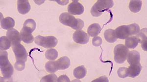 New single-dose drug 95 per cent effective against sleeping sickness in adults: Lancet study