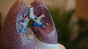 Up to 11% of Covid cases that needed hospitalisations had lung scarring: US study