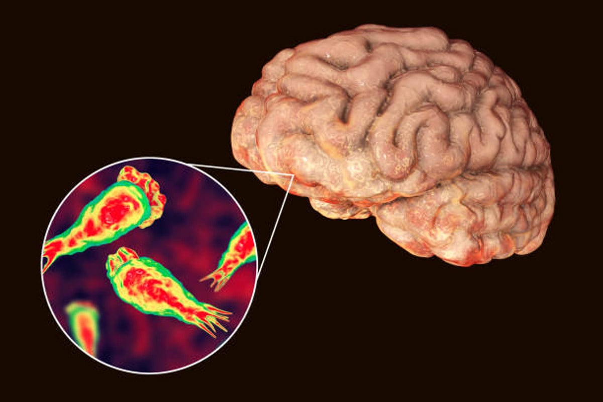 First infection of 'brain-eating amoeba' reported in S.Korea