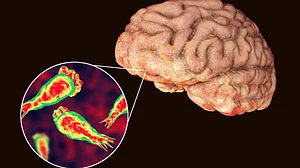 First infection of 'brain-eating amoeba' reported in S.Korea