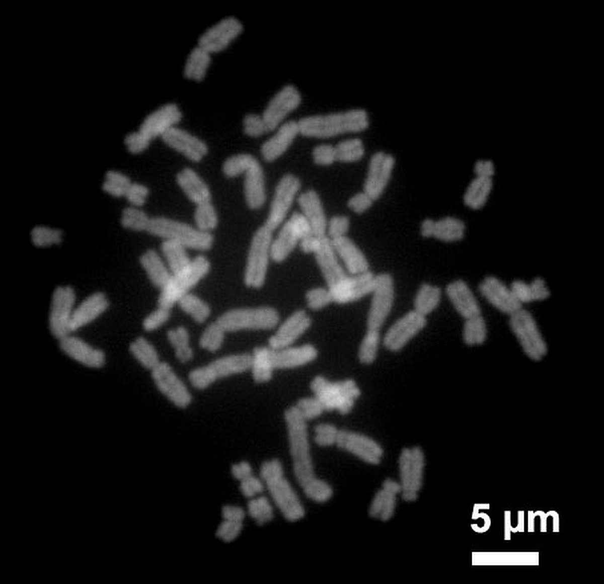Men are slowly losing their Y chromosome; a new sex gene discovery in spiny rats brings hope for humanity