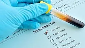 K'taka on alert as first case of Zika virus surfaces