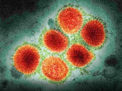 WHO reports first death from H3N8 virus in China